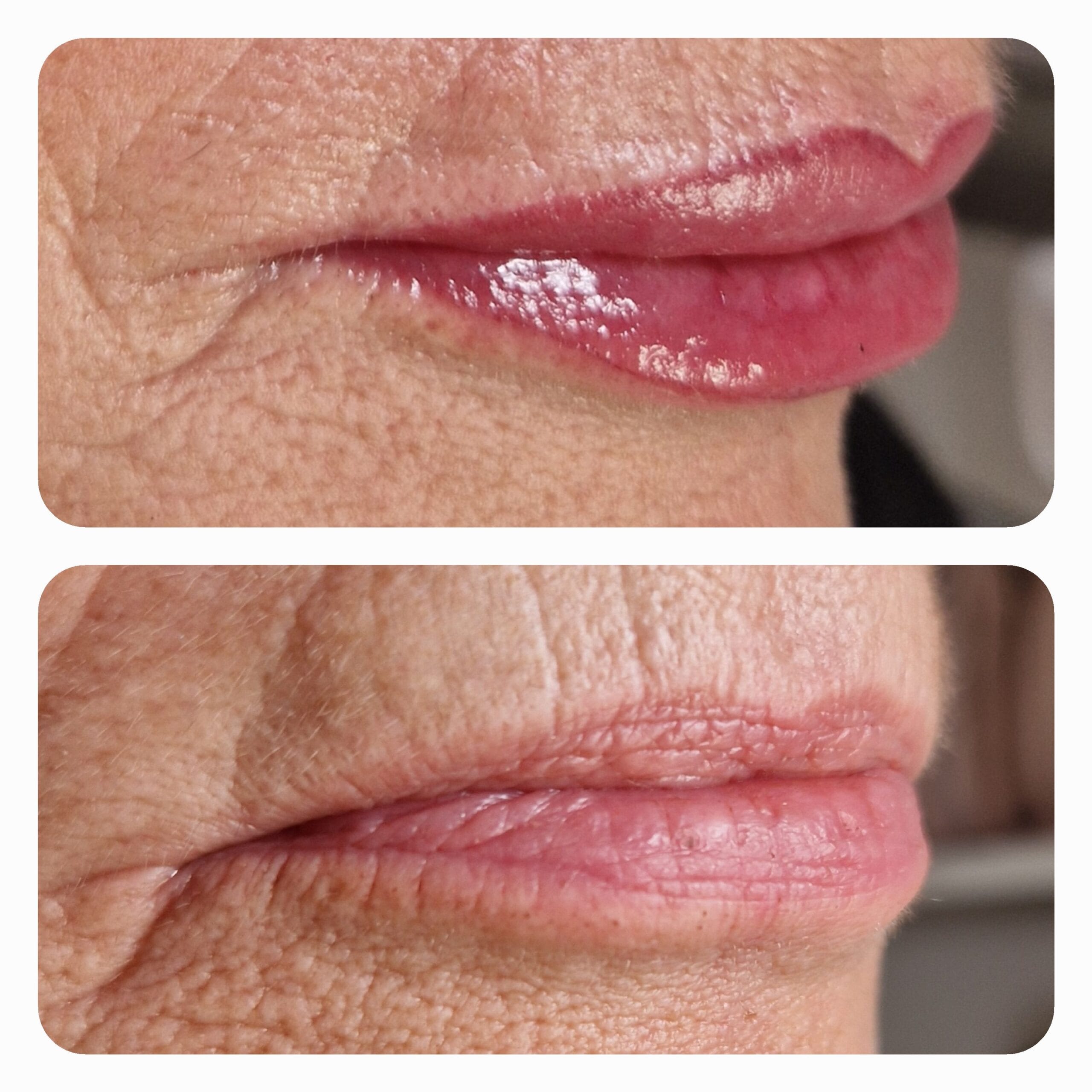 Schönes Ergebnis von permanent geschminkten Lippen