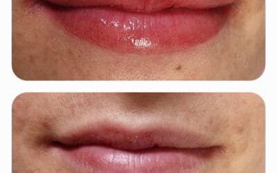 Permanent Make-up Lippen: Dauerhaft schöne Konturen & Farbe