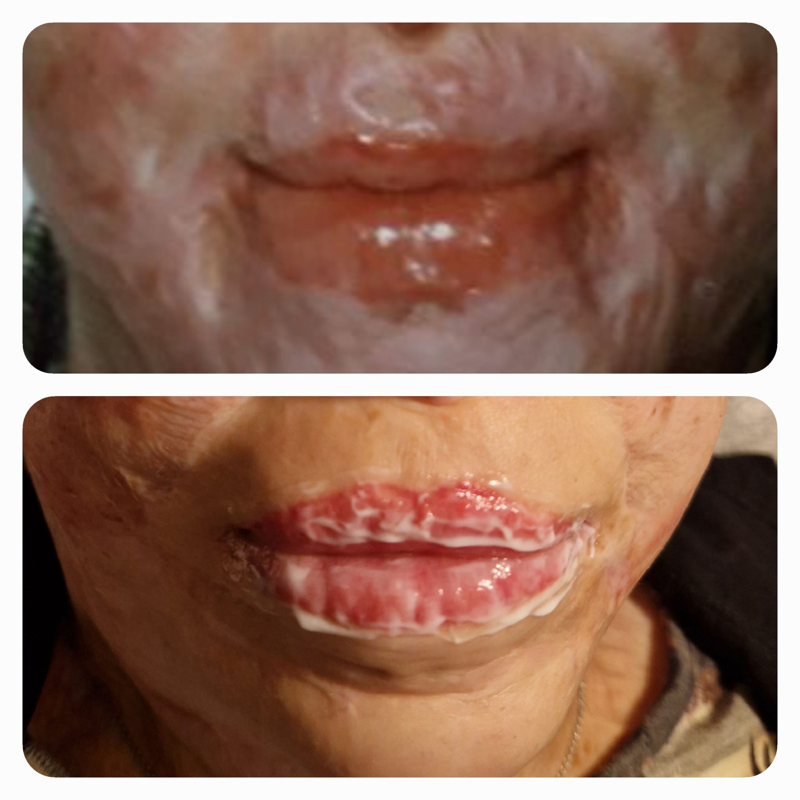 Detailaufnahme von Lippen nach Permanent Makeup Behandlung